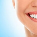 Teeth Whitening – 5 Natural Methods That Work