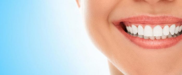 Teeth Whitening – 5 Natural Methods That Work